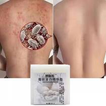 Miaofutong silk protein essence soap in addition to mite soap Li Jiaqi recommended face soap to remove mites to acne acne face