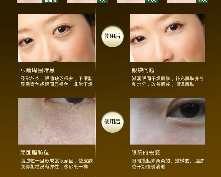 Đích thực Thái BB Vẻ Đẹp Tự Chọn Lansley Vàng Nguyên Chất Chống Nhăn Chăm Sóc Mắt Kem Mắt mặt nạ mắt collagen