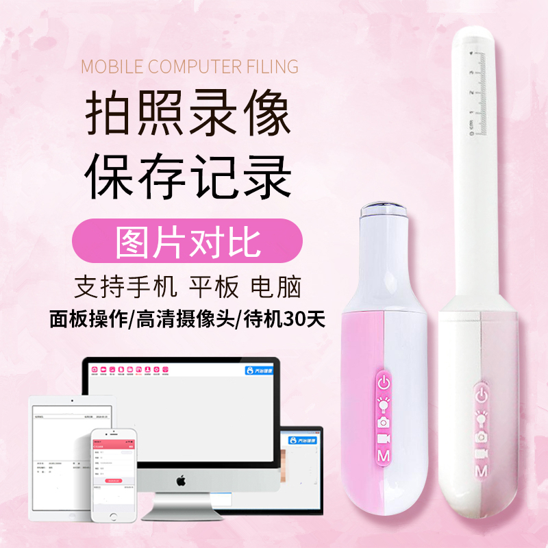 Wireless colposcopy Gynecological visual inspection Cervical intimate examination instrument Vaginal endoscopy detection HD beauty salon