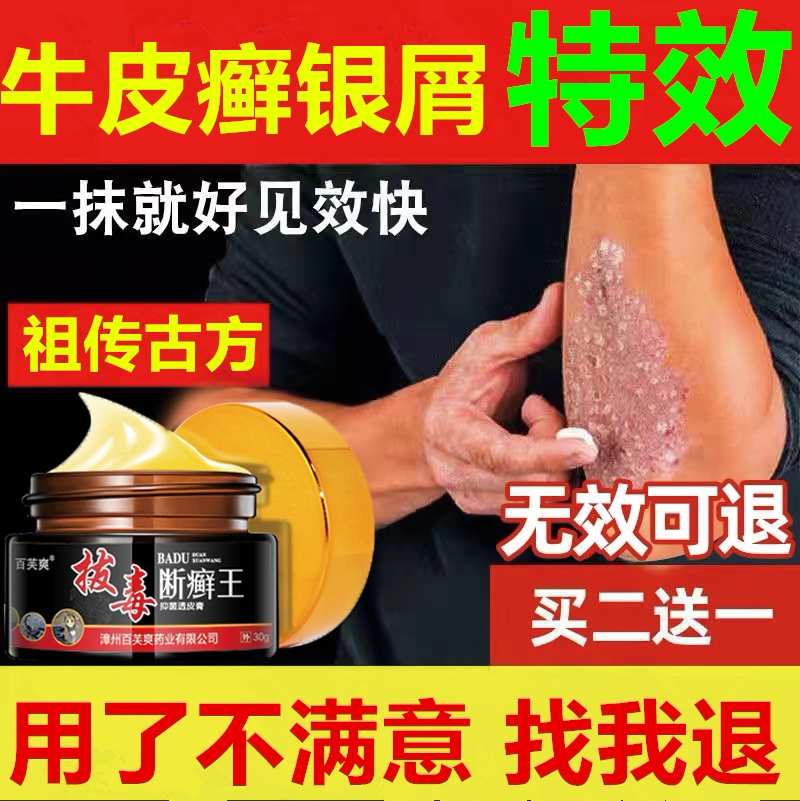 Special medicine for the treatment of psoriasis psoriasis