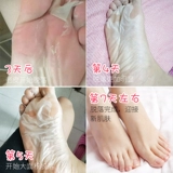 Японское отбеливающее отшелушивающее масло для ног для ступней против мозолей, содержит лошадиное масло, пилинг