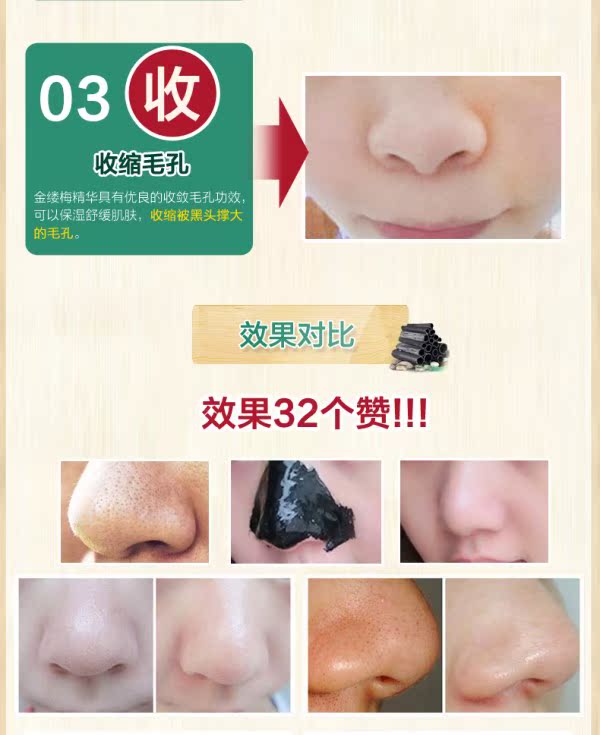 Nicholas tre than để mặt nạ đen xé rách lỗ chân lông ngoài mụn trứng cá nam nữ phù hợp với mũi mạnh mẽ mặt nạ làm trắng da