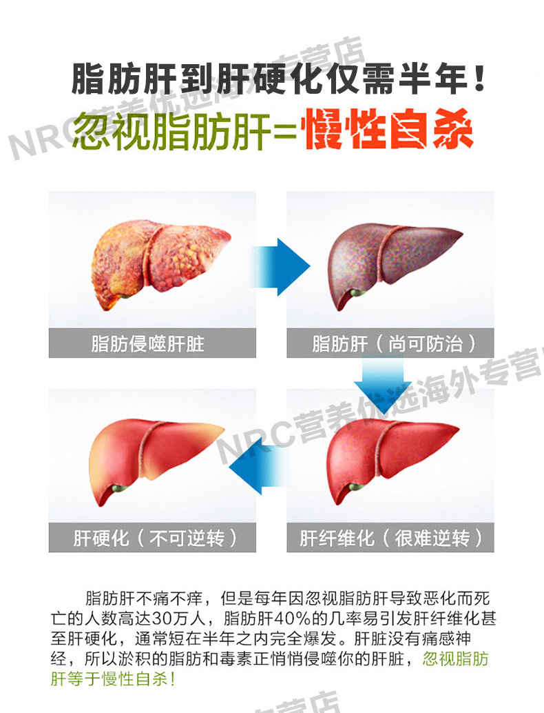Mỹ nhập khẩu cây kế sữa, gan, Ning, lưu huỳnh, axit, gan, gan, gan, giải độc, sản phẩm y tế, nước, viên nang bay - Thức ăn bổ sung dinh dưỡng bổ sung kẽm