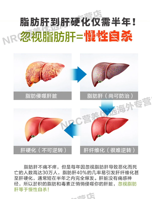 Mỹ nhập khẩu cây kế sữa, gan, Ning, lưu huỳnh, axit, gan, gan, gan, giải độc, sản phẩm y tế, nước, viên nang bay - Thức ăn bổ sung dinh dưỡng viên tảo uống