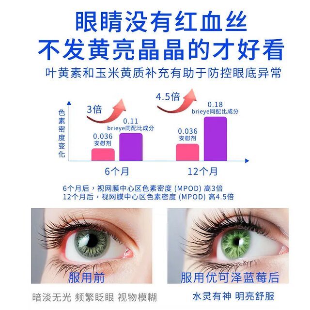 Ukzen · Ukzen Lutein for Vision Loss, Blurred Vision, and Myopia for Children and Adults, Official Genuine Product 3Cy