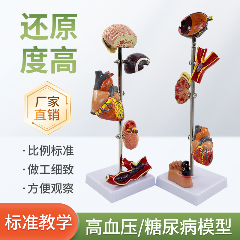 高/血压模型 糖尿/病变内脏模型病态血压 病理脑 眼心脏肾脏血管