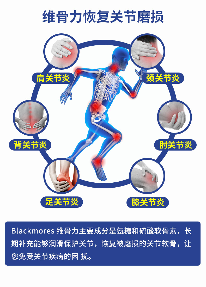 Úc 骨 骨力 blackmores Glucosamine Chondroitin 180 Glucosamine Sản phẩm sức khỏe trung niên - Thức ăn bổ sung dinh dưỡng tảo nhật