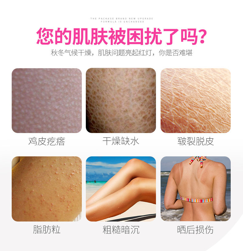 Sữa dưỡng thể dưỡng ẩm cho cơ thể dưỡng ẩm cho da gà Kem dưỡng da Kem dưỡng da toàn thân chăm sóc nam nữ lăn khử mùi etiaxil