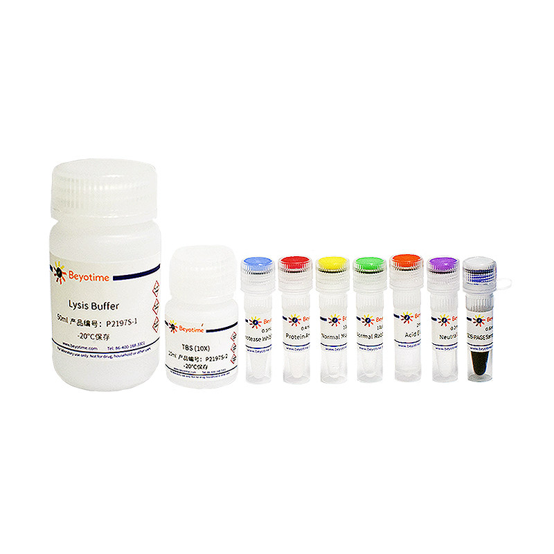碧云天  P2197S 免疫沉淀试剂盒(Protein A+G琼脂糖凝胶法) 20次