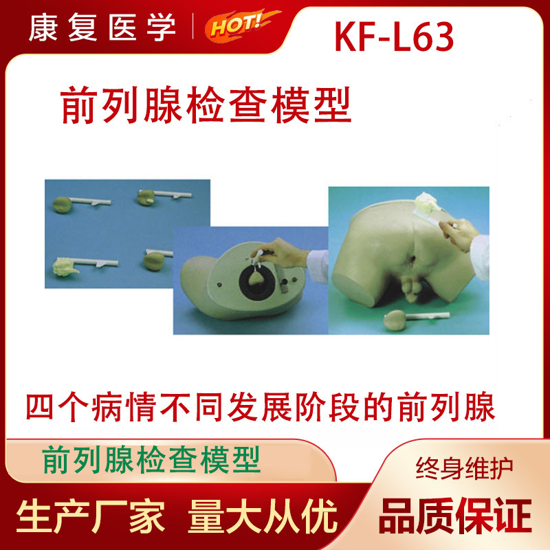 前列腺检查模型 四个病情不同发展阶段的前列腺