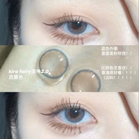 14.2mm