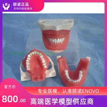 ENOVO Dental practice assessment Tooth extraction anesthesia tooth extraction model Oral surgery teaching practice model