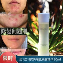 Chitin acne water enary carapace water Japan repair sensitive muscle essence oil control Toner wet compress water