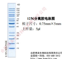 Wide molecular weight protein Marker (10KD-200KD) scientific research experiment can be invoiced 20T(100ul