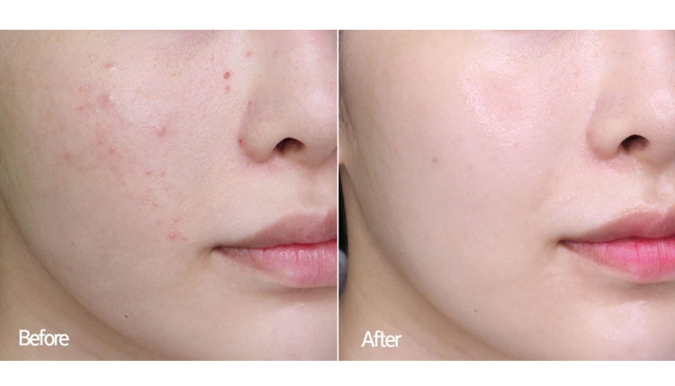 Sản phẩm quốc gia D18 Ceramide Moisturising Sửa chữa Mặt nạ Nữ Làm sáng da Hoàn thành tinh chất mặt 5 miếng kiehl's mặt nạ đất sét