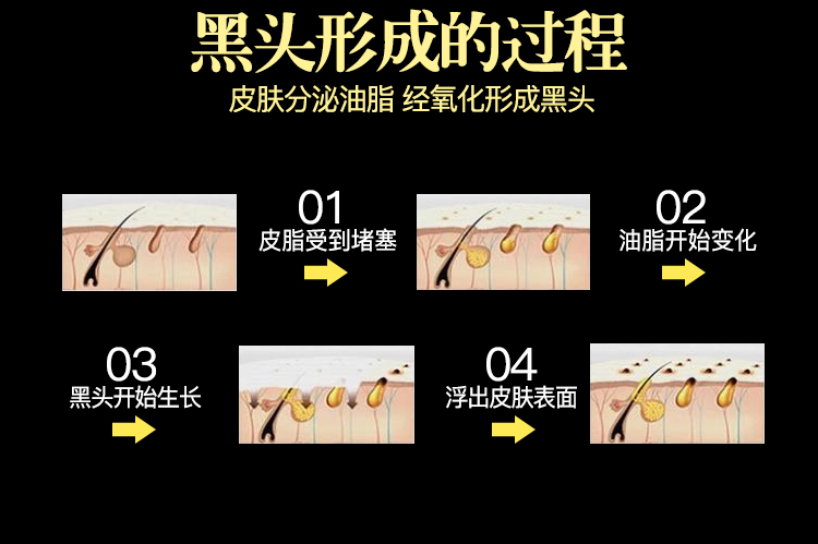 Blackhead Acne Mask Tear-Off Nasal Sticker Acne Cleansing Shrink Pore Set Artifact Đàn ông và phụ nữ không cai nghiện mặt nạ senka