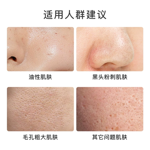 Florihana Шлем от черных точек, комплект с розмарином, гидролат, масло жожоба, масло для кожи, Франция, сужает поры