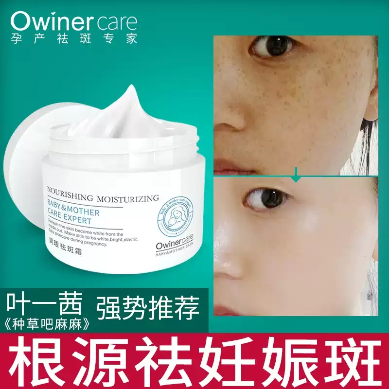 Orville Spot Removal Cream Whitening Lightening Pigmented Pregnant Women Face Cream After Childbirth Go To Pregnancy Spot Melasma Moisturizer