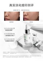 Han Hangu freeze-dried powder nicotinamide oligopeptide 3 seconds essence brightens skin color downplay official website