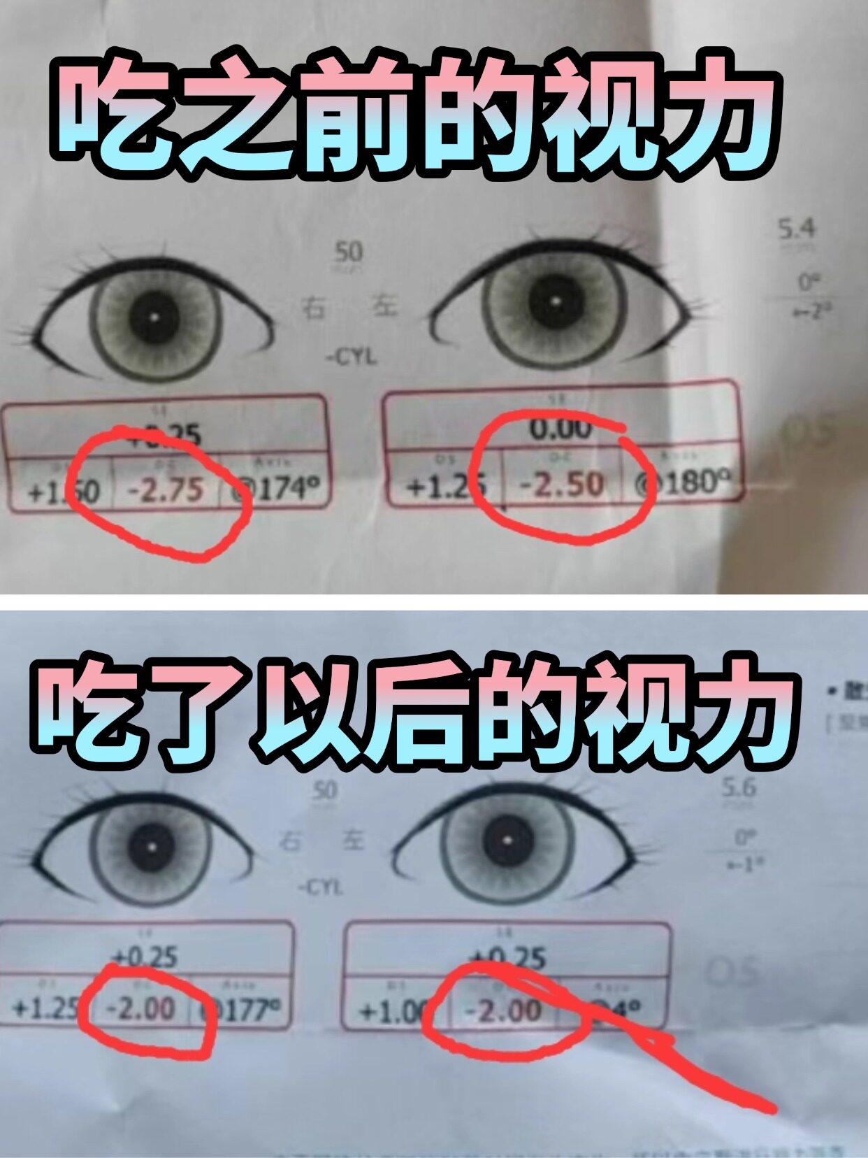 乐睛视力营养素到底值不值得入?聊聊孩子服用后的真实感受!