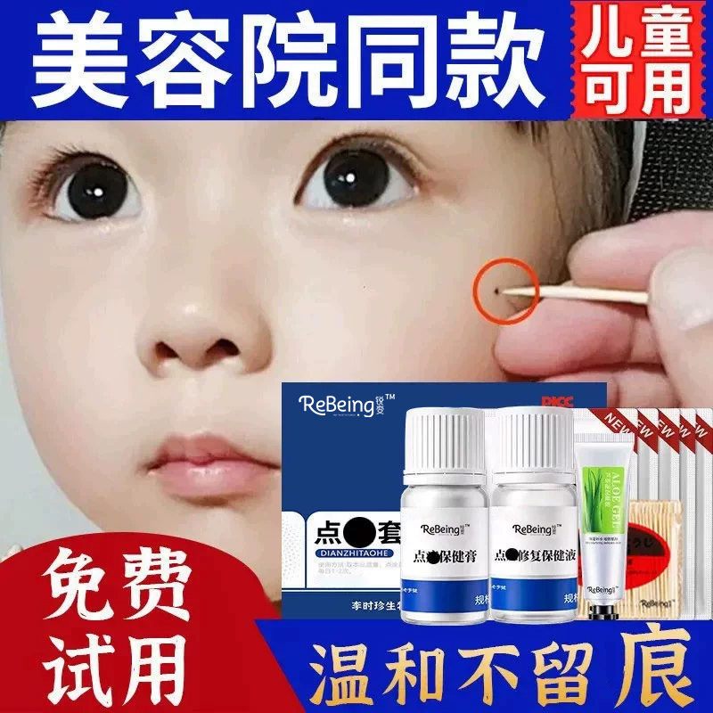 Spot Removal Cream, Genuine Product from Flagship Store, Beauty Salon Special for Face, Removes Black Spots Without Leaving Scars, Non-Medicated Solution Spot Removal Cream, Genuine Product from Flagship Store, Beauty Salon Special for Face, Removes Black Spots Without Leaving Scars, Non-Medicated Solution