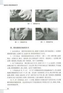 临床实用微创埋线技术 孙文善 微创埋线技术领域发展现状 生活 外科学 中国医学书籍 复旦大学出版社