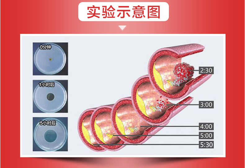 Mỹ nhập khẩu bây giờ Noona Bean Kinase Viên nang 60 viên cho bệnh nhân trung niên và cao tuổi bị nhồi máu não mềm - Thức ăn bổ sung dinh dưỡng viên uống bổ sung canxi