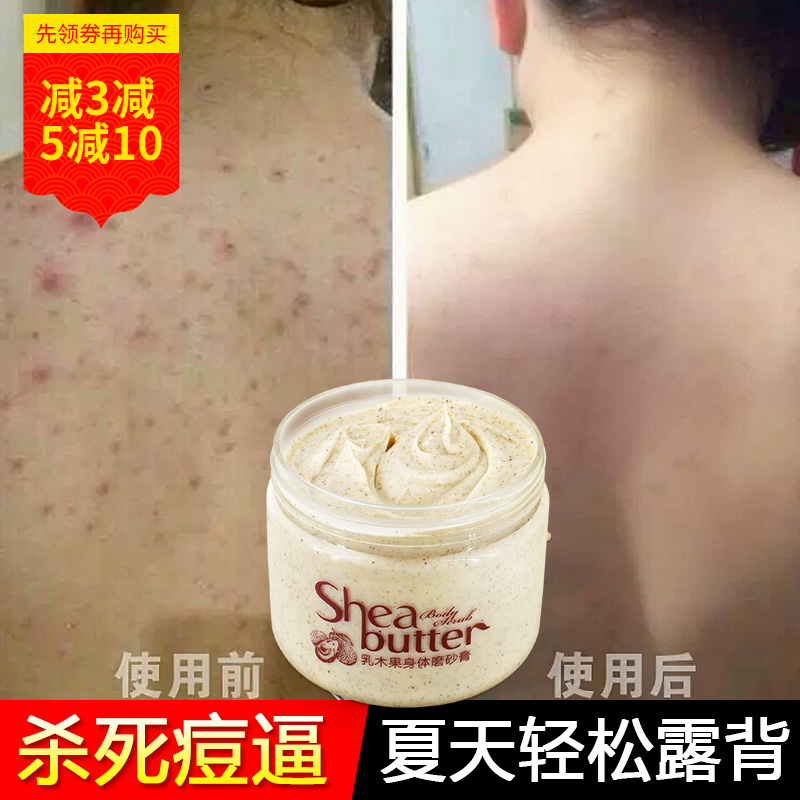瑜然美乳木果身体磨砂膏310g全身去角质死皮鸡皮肤疙瘩男女