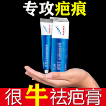 Go for removing pasta children special childrens face scratches and bruises to remove scratches no marks baby to print stitches bronzed and injured