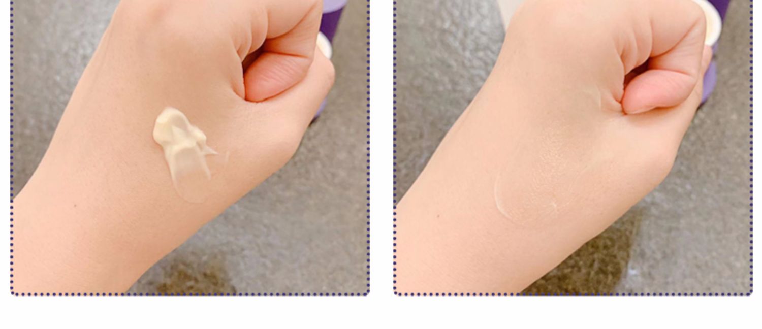 Úc Phụ nữ kem nhân sâm Chantelle Shanna Luer Kem tuyết cô đặc 祛 huyết thanh tế bào vàng và đá - Kem dưỡng da dưỡng ẩm da dầu mụn