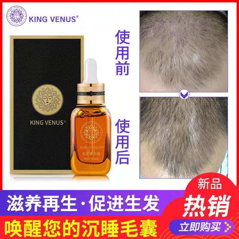 KINGVENUS to Zun Venus Development Fat Hair Growth Line Hair Growth Men And Women Anti-Hair
