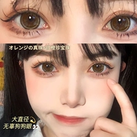14.5mm