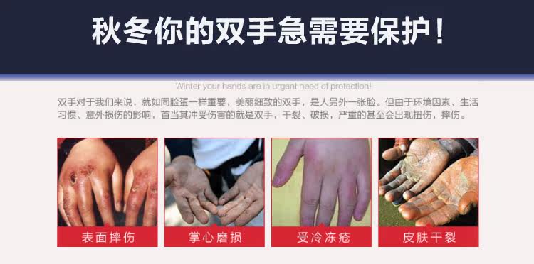 Gants pour vélo mixte LANDON - Ref 2239008 Image 9