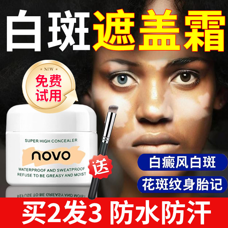 Vitiligo White Spot Concealer Liquid Concealer Waterproof and Sweat-Proof Skin Face Tattoo Bump Scar Covering Magic Cream