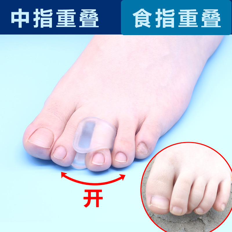 Adult Index Finger and Middle Finger Overlap and Bend Toe Corrector to Prevent the Third Toe from Turning Inwards and Forming a Claw-Like Split Toe