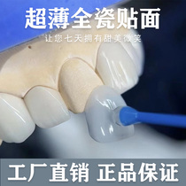 Dental veneers all-ceramic dental veneers Ivoclar all-ceramic dental veneers dental veneers dental porcelain veneers whitening dental veneers