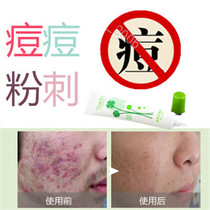 Remove forehead acne and rosacea for men and women. Repair acne essence to remove acne on chest and back.