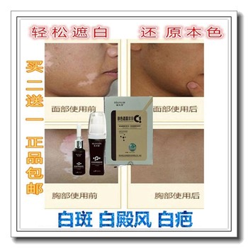 ຈຸດດ່າງດໍາ whitening palace ointment concealing liquid repair color skin color concealer pen cream ທົນທານຕໍ່ພາຍນອກກັນນໍ້າ ກັນເຫື່ອ ແລະຄວາມມັນ