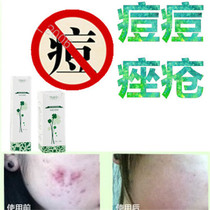 Miracle Herbal Removes Chest Front and Back Acne Repair Liquid Acne Acne Cream Removes Closed Acne