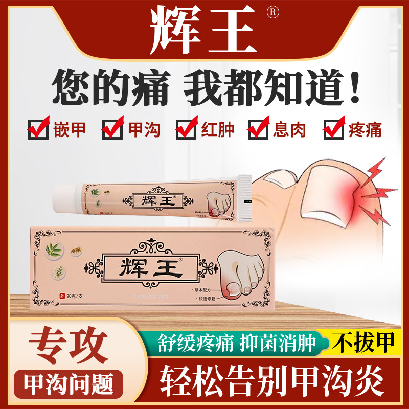 Hui Wang Yutian (Official) A Trench Meat Sprout Polyp in the Lotte King Lehui Wang Chia Gou Pain Cream 4-Taobao