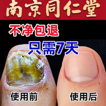 ⭐Tongrentang Hot Sale (Painless Potassium Replacement in 7 Days)⭐One drop will turn bad nails into good ones inhibit bacteria without removing nails