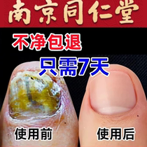 ⭐The Tongenttang Fever продается (7 дней без боли за новый калий)⭐Drop a drop of a bad nail for a goin jia bacterostatic no.