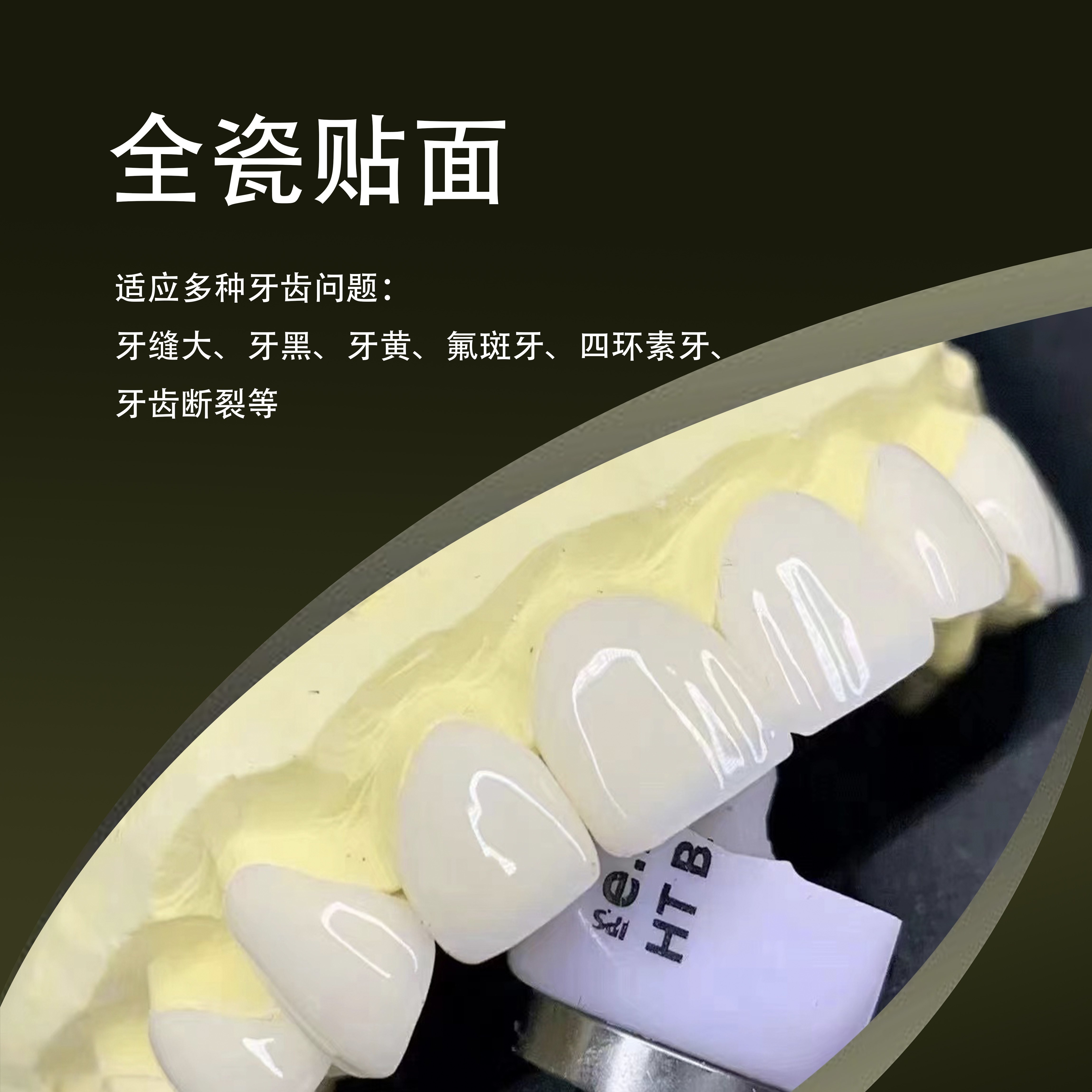 瓷贴面厂家