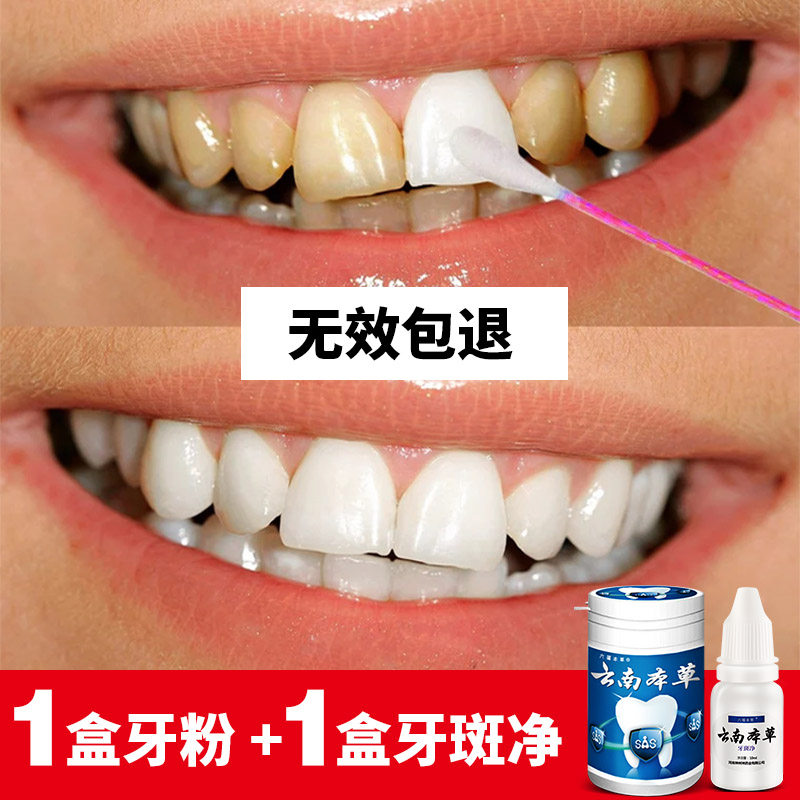 Yunnan Benherbal matching suit white teeth washing teeth powder to smoke stains dental plaque Dental Plaque dental plaque Tooth Gum Bleeding