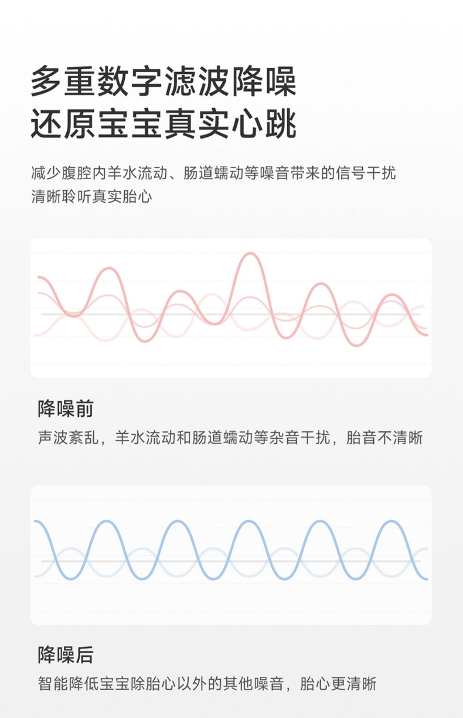 【中國直郵】魚躍 孕婦家用超音波多普勒胎動胎心檢測儀無輻射 YTX302