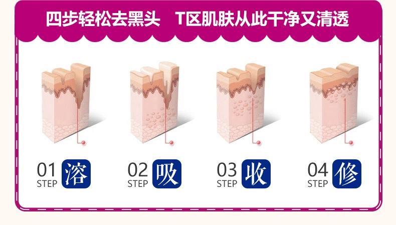 泉 雅 面 Mặt nạ Aloe Vera để Blackhead Hydrogel Cream To Whitehead Mask Tear-Off Nasal Membrane - Mặt nạ