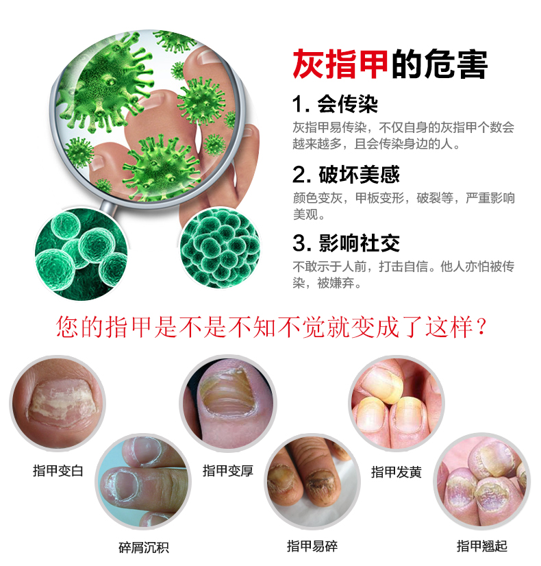 点击打开原图