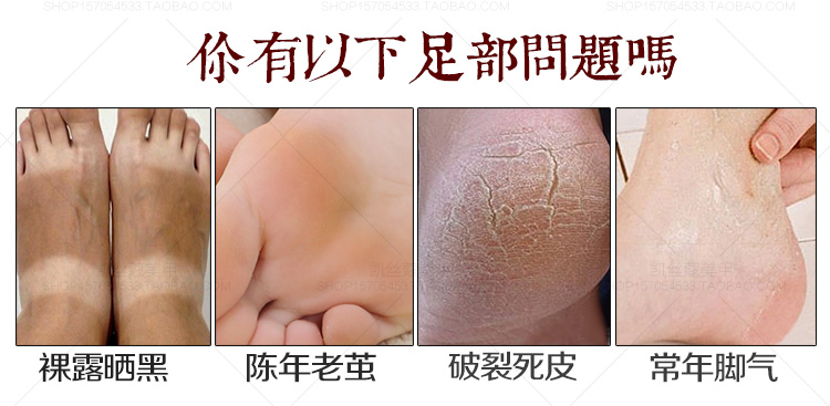 Care 迪 黄金 Chăm sóc chân collagen đặt kem dưỡng da cho da chết vào bộ phim chân công cụ dưỡng ẩm cũ thuốc trị nứt chân