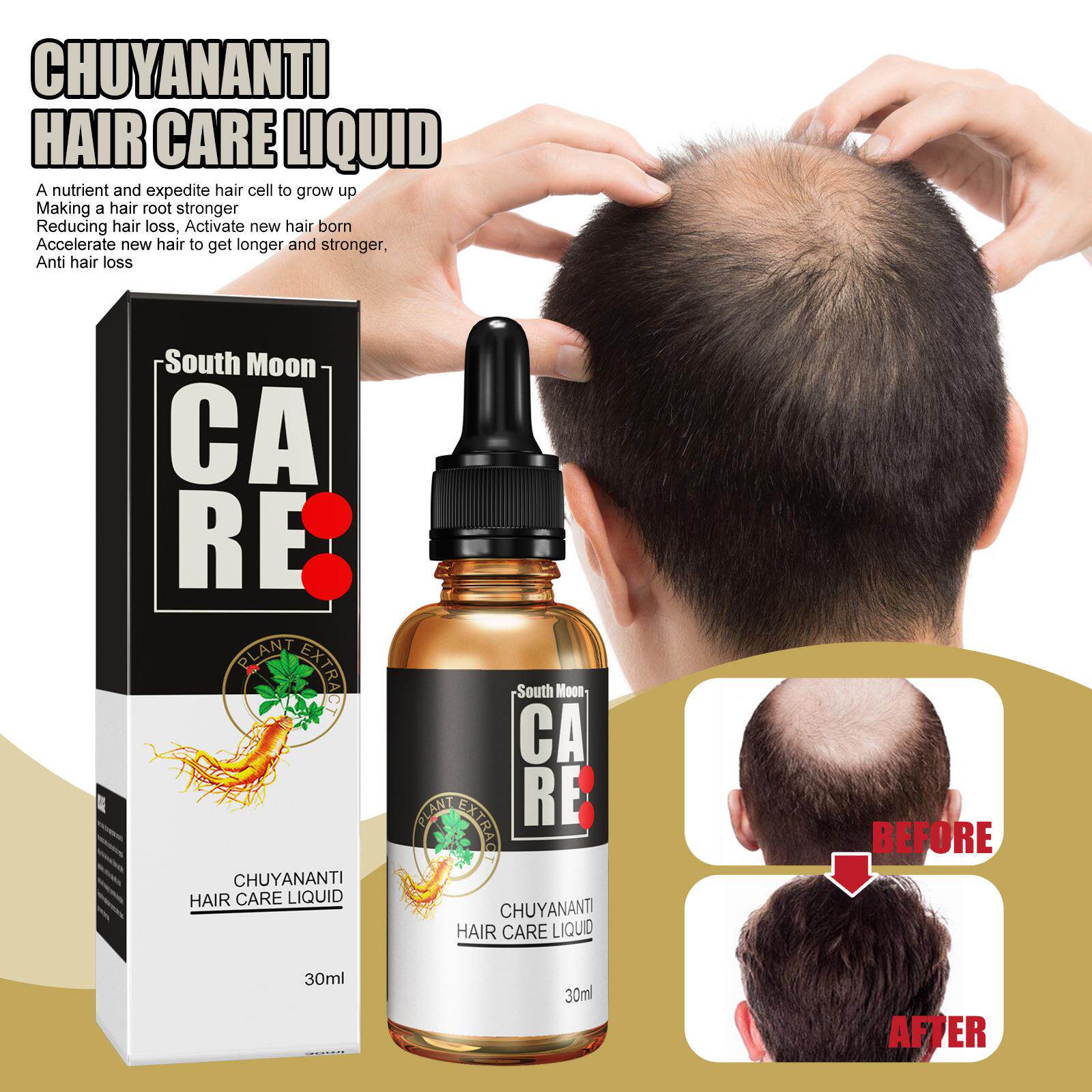 Hair Growth Serum Scalp Treatment 30ml Formula - Product image 7