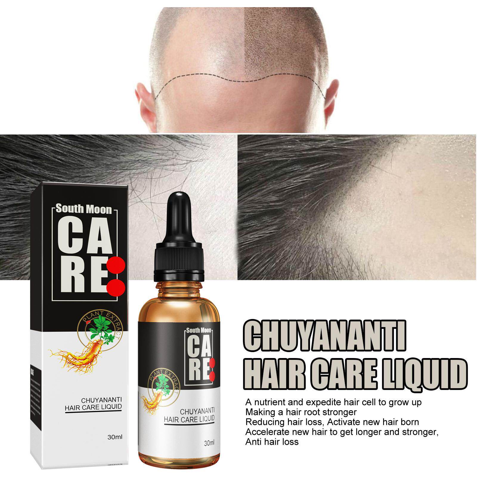 Hair Growth Serum Scalp Treatment 30ml Formula - Product image 8